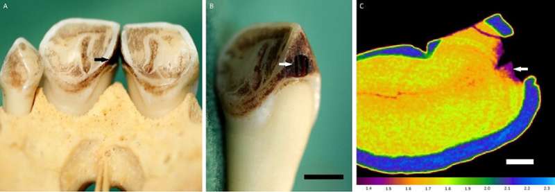 Tooth cavities provide unique ecological insight into living primates and fossil humans