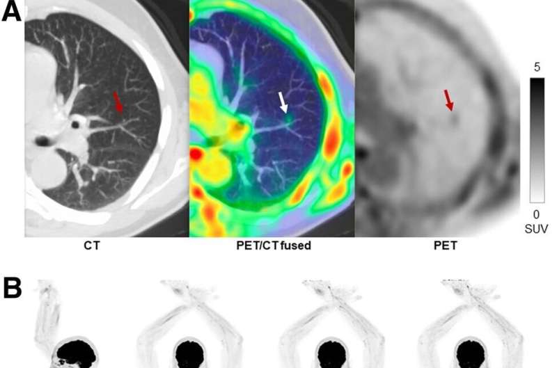 Total-body PET imaging exceeds industry standards