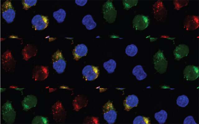 Two anti-viral enzymes transform pre-leukemia stem cells into leukemia