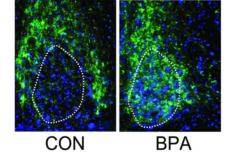 UCalgary study shows BPA exposure below regulatory levels can impact brain development