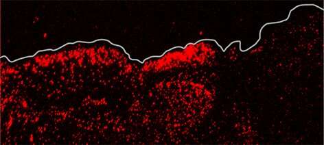 محققان UCI نقش حیاتی مکانوسنسور را در ترمیم زخم پوست نشان دادند
