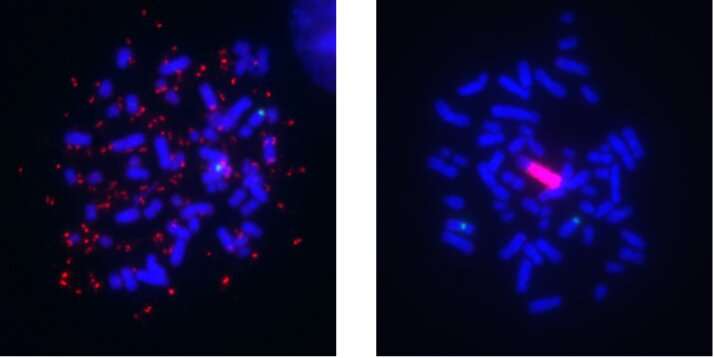 UCLA Jonsson Comprehensive Cancer Center study details chromosome-level changes that allow melanomas to develop drug resistance