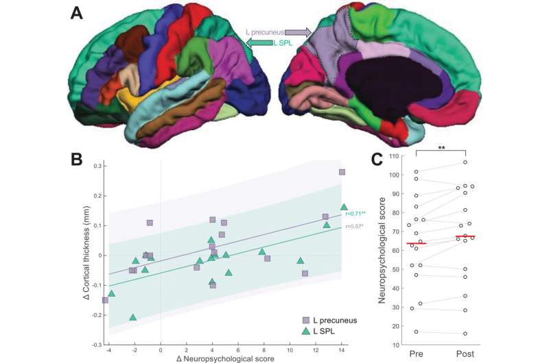 Ultrasound brain stimulation slows dementia-related brain degeneration