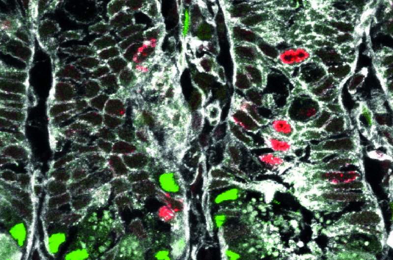 Uncovering basic mechanisms of intestinal stem cell self-renewal and differentiation