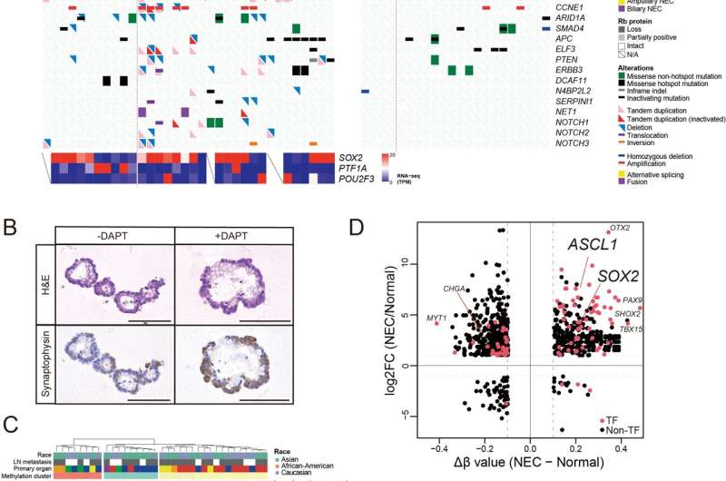 Up to our NECs in it: in-depth genomic analysis of a rare carcinoma