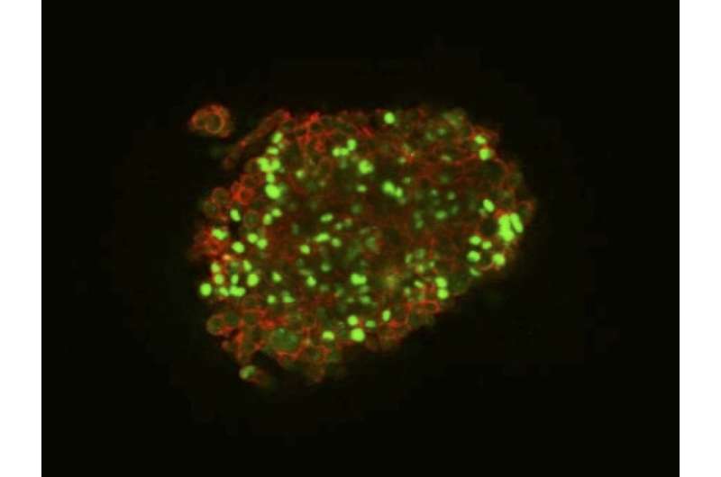 Uprooting cancer: Hydrogel rapidly reverts cancer cells back to cancer stem cells