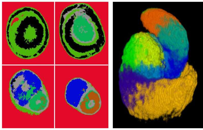 USC-led study traces the blueprints for how human kidneys form their filtering units