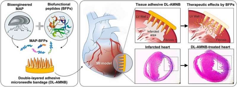 Using mussel adhesive proteins for cardiac tissue regeneration