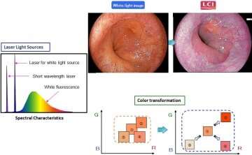Viewing upper gastrointestinal cancers in a new light