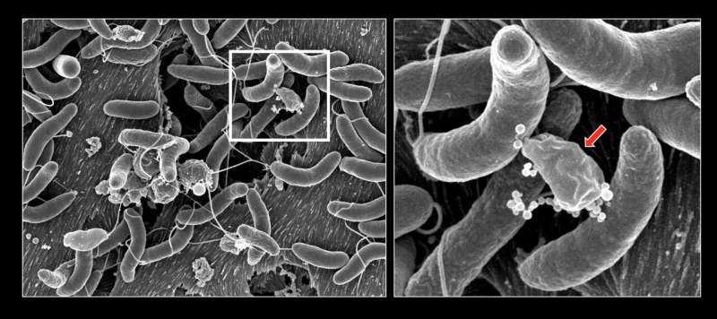 War in the gut: How human microbiota resist the cholera bacterium