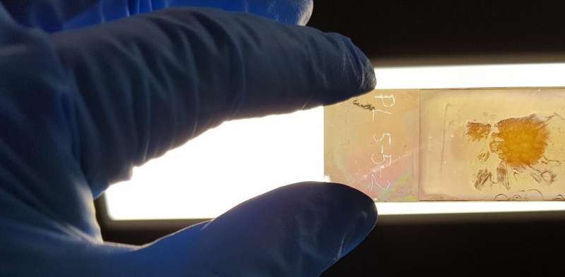 We created a microscope slide that could improve cancer diagnosis, by revealing the 'colour' of cancer cells