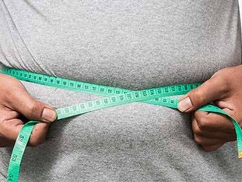 Weight-loss surgeries used least in U.S. states that need them most