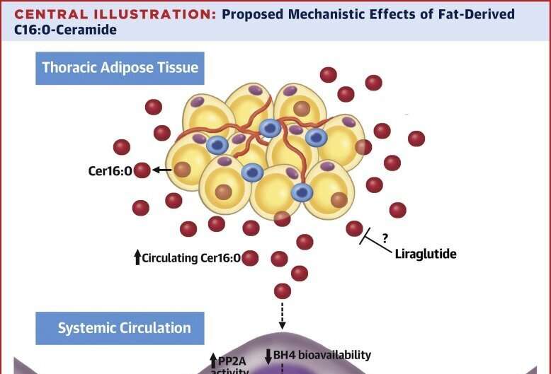 Weight-loss treatment prevents accumulation of lipid linked to cardiac mortality