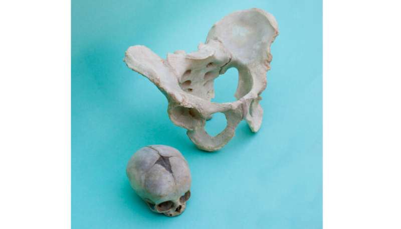 Where do the gender differences in the human pelvis come from?
