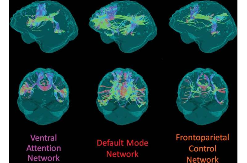 White matter integrity disrupted in people with Alzheimer’s gene mutation