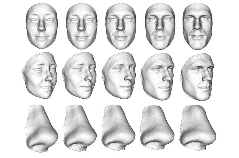 3D facial analysis shows biologic basis for gender-affirming surgery  