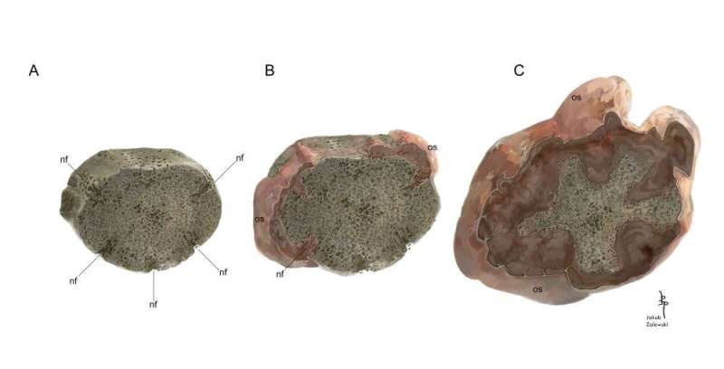 A bone cancer tumor more than 215 million years old