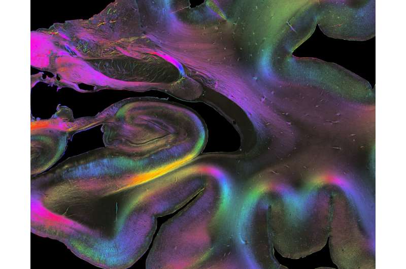 A combination of micro and macro methods sheds new light on how different brain regions are connected