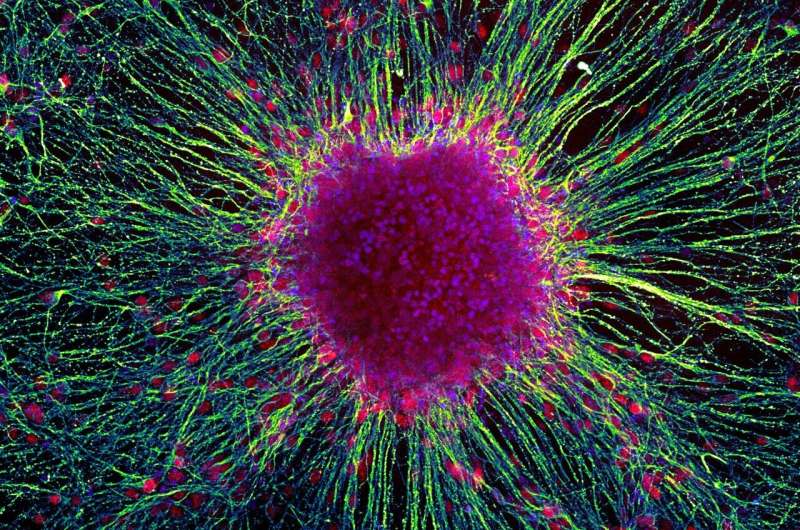 A dimmer switch for human brain cell growth