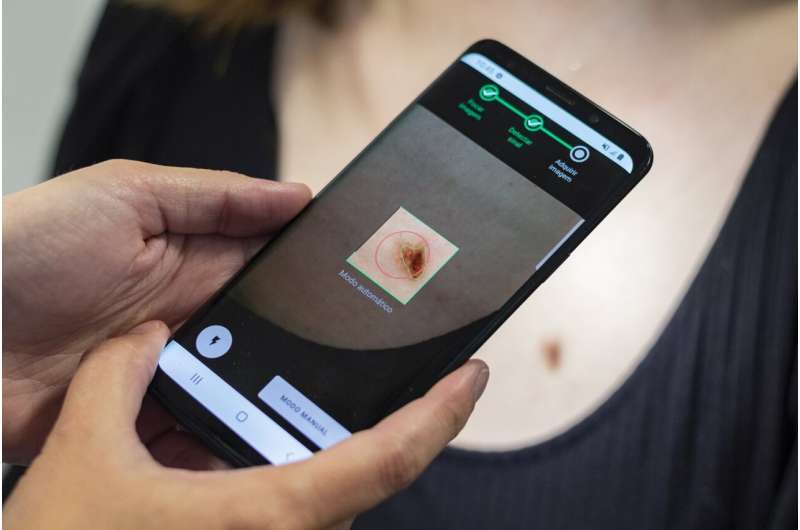 A mobile app and AI software to speed up skin-cancer diagnoses