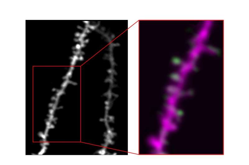A new framework describing the formation and development of learning-related dendritic spines