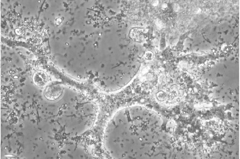 A new soil amoeba species discovered in the "Siberian jungle"