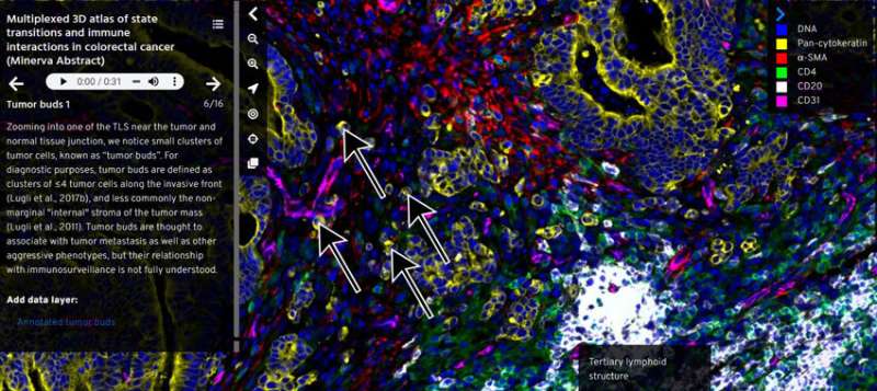 A new tool makes high-resolution imaging data on human tissues easier to understand and use