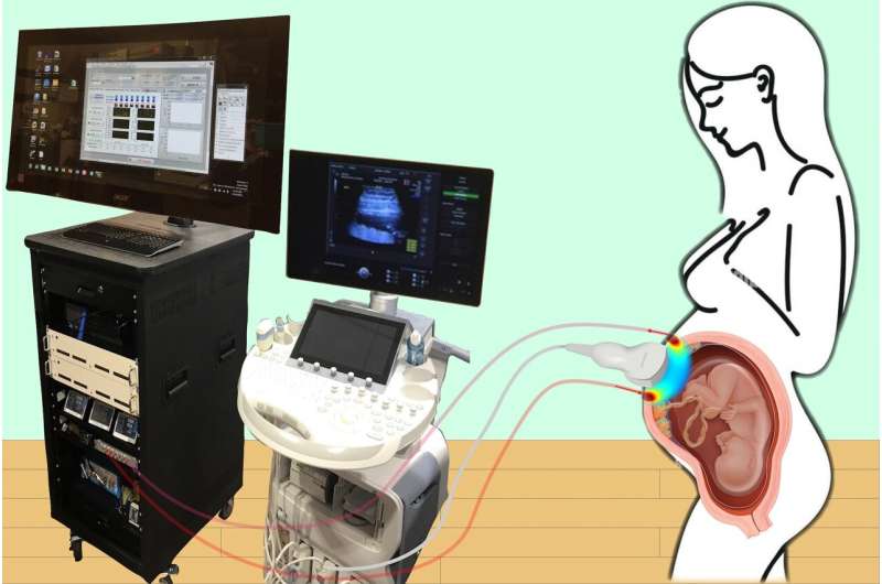 A novel method for monitoring the ‘engine’ of pregnancy