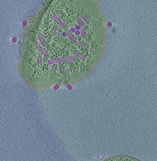 A unique defence: Bacteria lose cell wall in the presence of virus