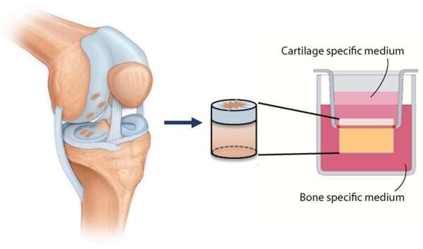 A workout for cartilage implants