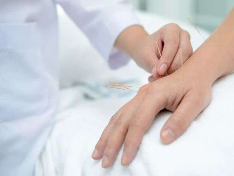 Adjunctive acupuncture may speed relief from pain of renal colic