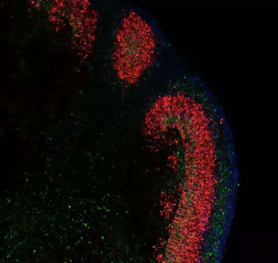 Advanced “mini brains” in the dishOrganoids that mimic human brain cortex in development and disease