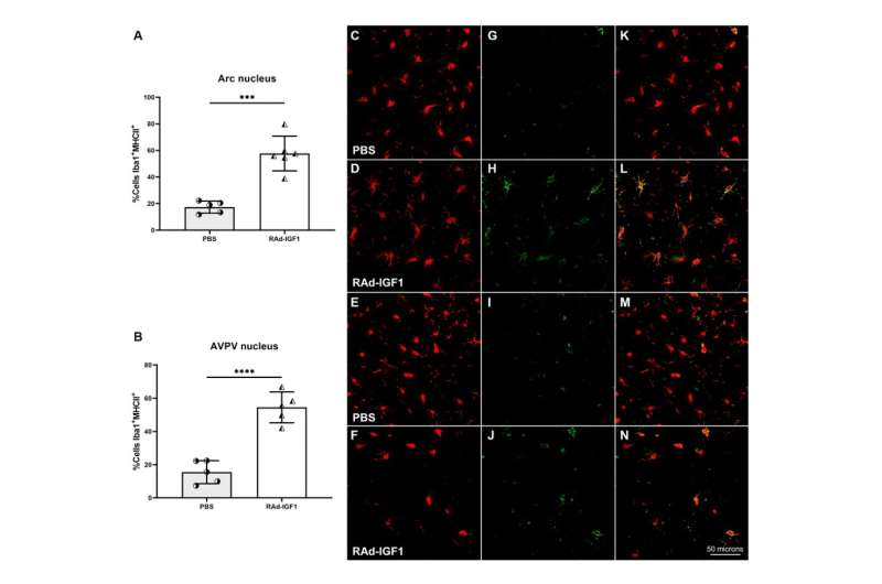 Aging | IGF1 gene therapy in middle-aged female rats delays reproductive senescence through its effects on hypothalamic GnRH and