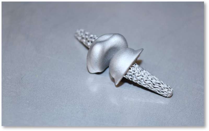 AI enables greater mobility: Personalized finger joint implants from a 3D printer