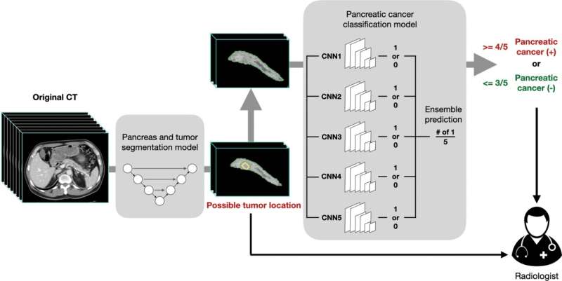 AI helps detect pancreatic cancer