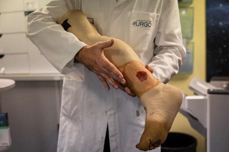 Un ricercatore di Urgo mostra una ferita che potrebbe essere curata con una pelle artificiale