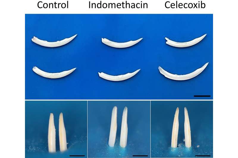 Anti-inflammatory drugs commonly taken by children can cause alterations to dental enamel, study shows