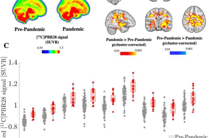 Are pandemic-related stressors impacting brain health of uninfected people?