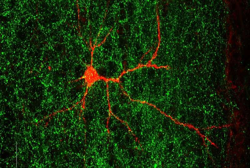 Autism-linked gene shapes nerve connections