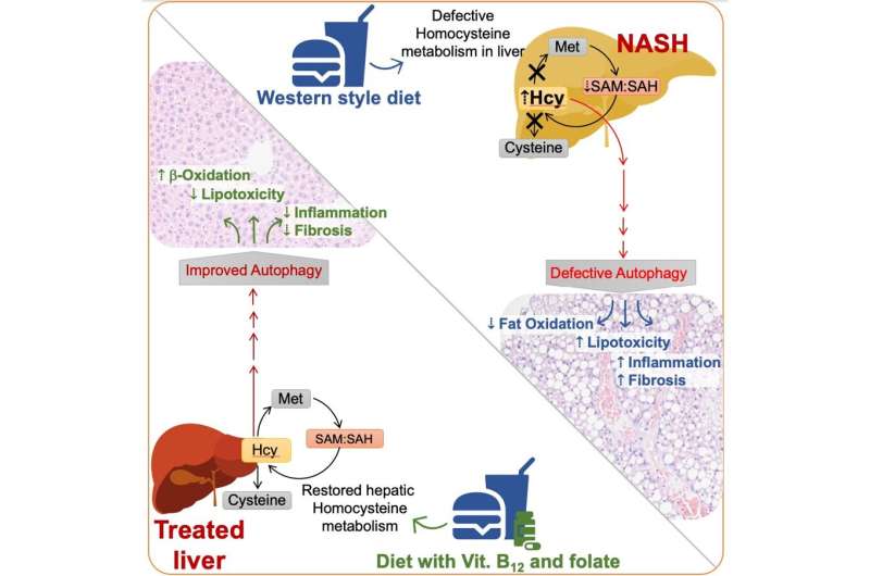 Витамины группы В потенциально могут быть использованы для лечения запущенной неалкогольной жировой болезни печени: Duke-NUS