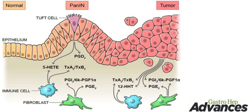 Biologists discover signaling pathways potentially associated with pancreatic cancer