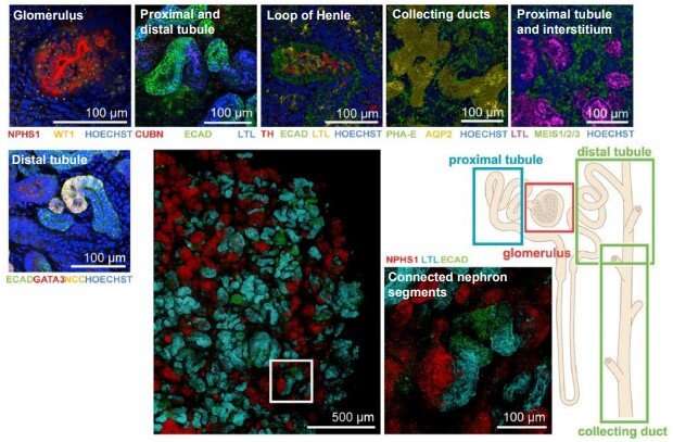 Biomaterials for kidney organoid–based regenerative therapy