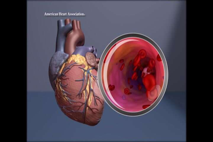 Black and Hispanic adults faced disparities in initial heart attack care
