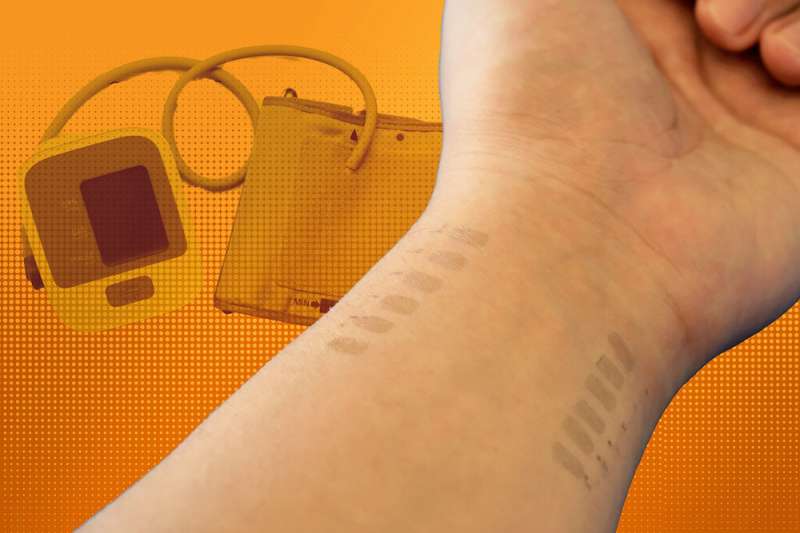 E-tattoo della pressione sanguigna promette un monitoraggio continuo e mobile