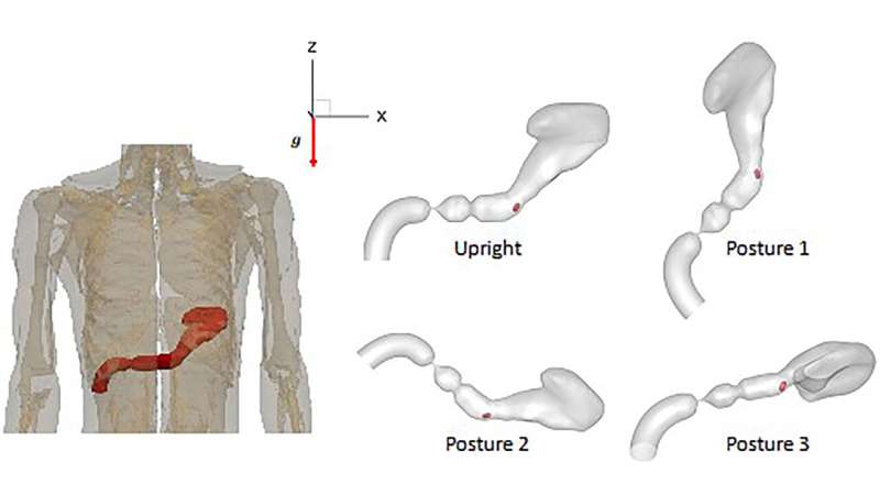 Body posture affects how oral drugs absorbed by stomach