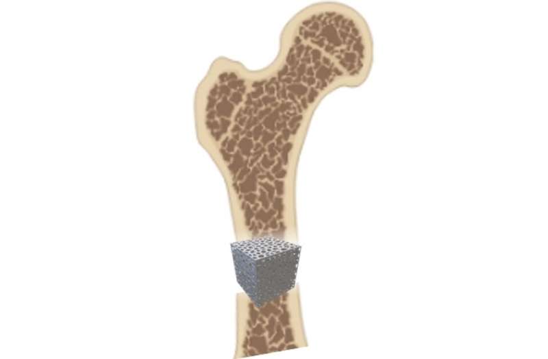 Bone-building cells favour different orthopaedic implant designs