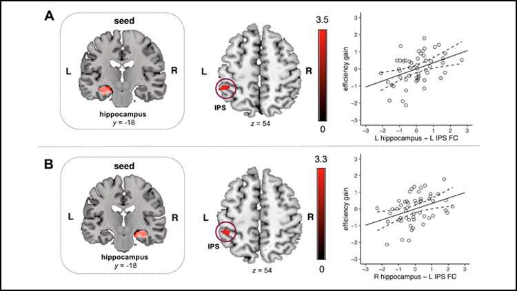 Brain circuit strength predicts a child's ability to understand numbers