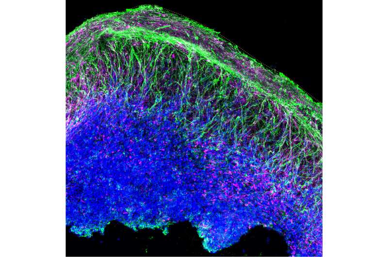 Brain-like organoids grown in a dish provide window into autism