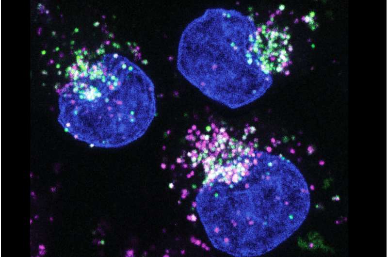 Breaking down proteins: How starving cancer cells switch food sources