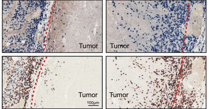 Cancer cells selectively load ‘drones’ to keep T cells from infiltrating tumors